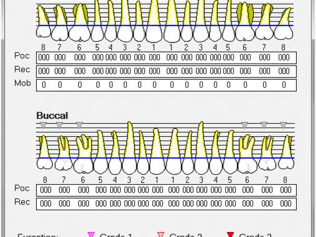 Periodontal Chart Template Creating A Perio Chart 