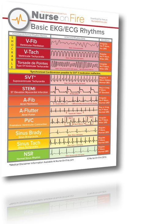 Nursing EKG Cheat Sheet Great For New Nurses To Identify 